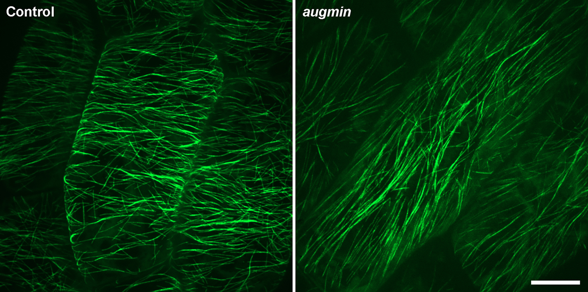 Green fluorescence microscopy images comparing control and aggregate formations.