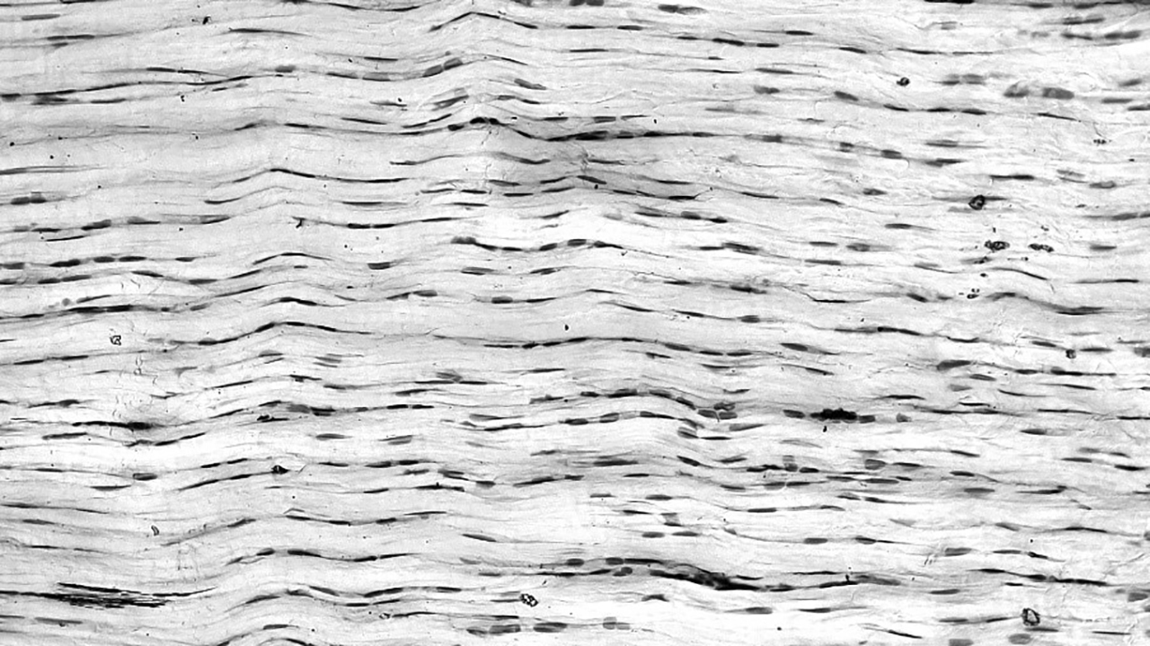 Black and white micrograph showing the fibrous, striated structure of a rat tendon, with elongated cells aligned in parallel rows along the collagen fibers.