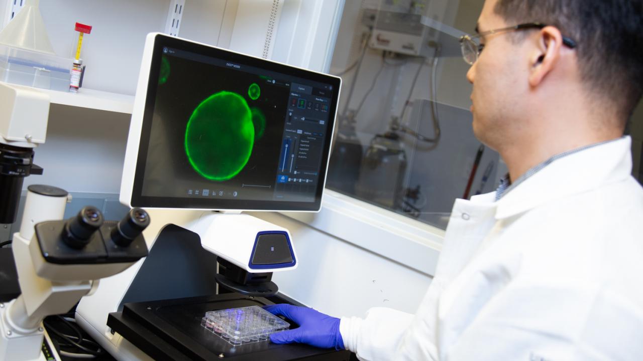 Organoids, on the computer screen in green, can help researchers track disease development and help them develop and identify patient-specific therapies for those diseases. David Slipher/UC Davis Chang-il Hwang and organoid