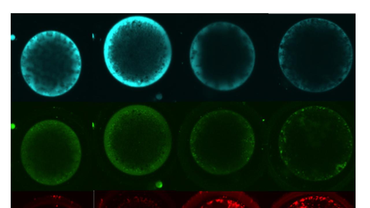 Each column represents an oocyte stained with markers of metabolism, such as anti-oxidants (blue), stress/reactive oxygen species (green) and active mitochondria (red, the cell’s “power station”). CNBP Oocyte cells