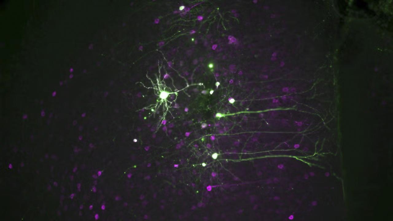 Microscopic image of neurons stained with fluorescent dyes, showing intricate branching and connections. The neurons are illuminated in bright green, highlighting their dendrites and axons, while surrounding cells appear in a purple hue. The image captures the detailed network of neural pathways against a dark background, emphasizing the complexity of cellular structures and connections within the brain tissue.