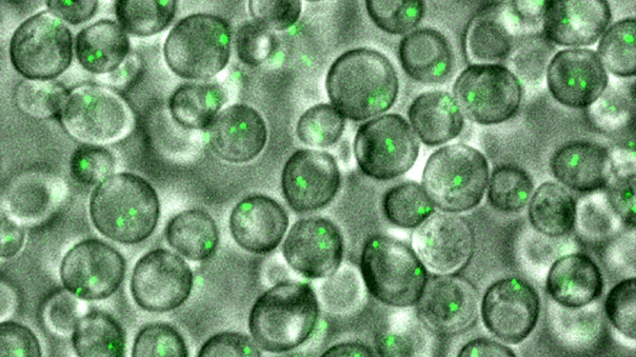 Saccharomyces cerevisiae yeast