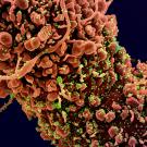 Coronavirus on cells