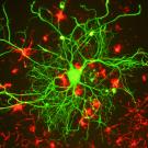 Researchers hope to gain a better visual perspective of the molecular mechanisms of the brain's continual rearrangement of neuronal connections, known collectively as brain plasticity. Gerry Shaw
