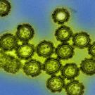 Viruses like these H1N1 influenza particles rely on host cells to reproduce, but they can still show social behavior, interacting with other viruses by competing, cooperating and sometimes cheating to succeed. This new behavioral approach to viruses could lead to new insights into how to control infectious diseases. Photo credit: NIH/NIAID