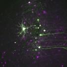Microscopic image of neurons stained with fluorescent dyes, showing intricate branching and connections. The neurons are illuminated in bright green, highlighting their dendrites and axons, while surrounding cells appear in a purple hue. The image captures the detailed network of neural pathways against a dark background, emphasizing the complexity of cellular structures and connections within the brain tissue.