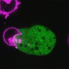 Fluorescent microscopy image showing a green-colored Entamoeba histolytica parasite in contact with several magenta-colored circular human T-cells, illustrating the parasite’s attack on immune cells.